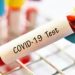 Oleada de pruebas para el COVID-19 no reguladas en Estados Unidos crea mucha confusión