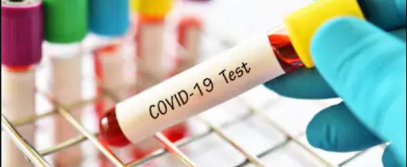 Oleada de pruebas para el COVID-19 no reguladas en Estados Unidos crea mucha confusión