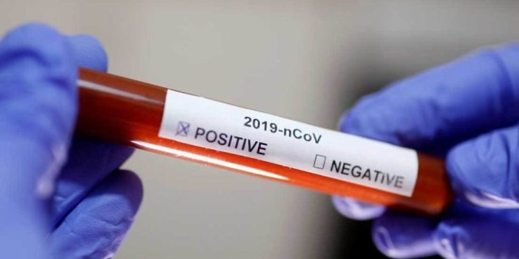 ¿Eres O Rh? Científicos indican relación entre tipo de sangre y riesgo de contraer COVID-19