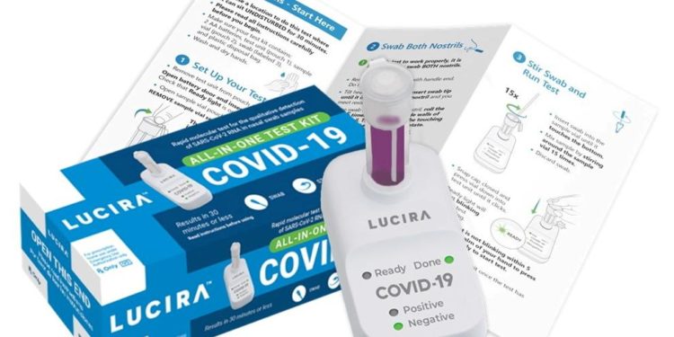¡Prueba casera! Cómo funciona el test para detectar el coronavirus en casa
