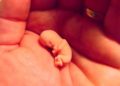 Derecho al aborto en EEUU: Wade Vs Roe, el caso que cambió la historia