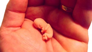 Derecho al aborto en EEUU: Wade Vs Roe, el caso que cambió la historia