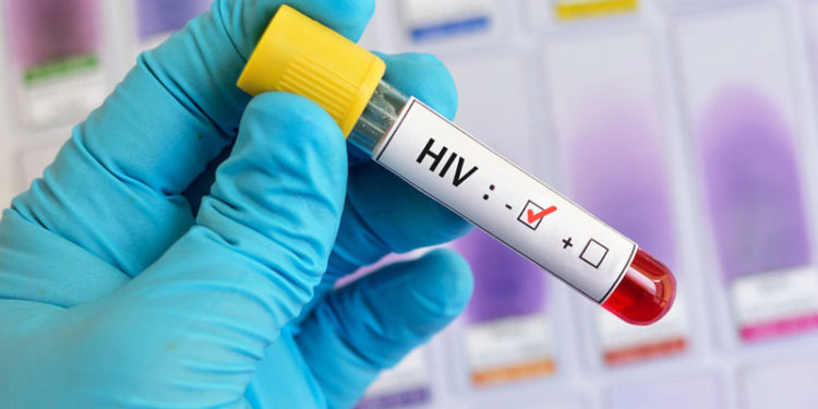 Ya van varios pacientes con VIH en el mundo que se curan con trasplantes de células madre.