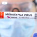 La viruela del mono posee una capacidad de contagio muy baja.