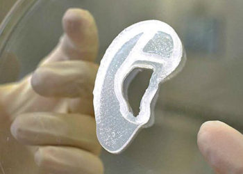 Médicos trasplantan oreja hecha en impresora 3D con células humanas