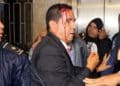 Crisis parlamentaria en Honduras: varios lesionados tras disturbios en el Congreso