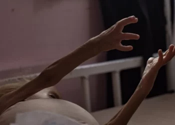 Israel reitera que la «mayoría» de muertes atribuidas al hambre en Gaza son por enfermedad